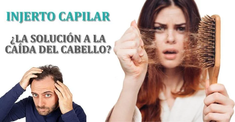 Caída del cabello - Medican Clinics